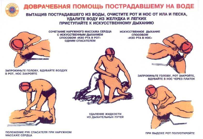 Первая помощь при клинической смерти, особенности состояния, действия для спасения жизни человека