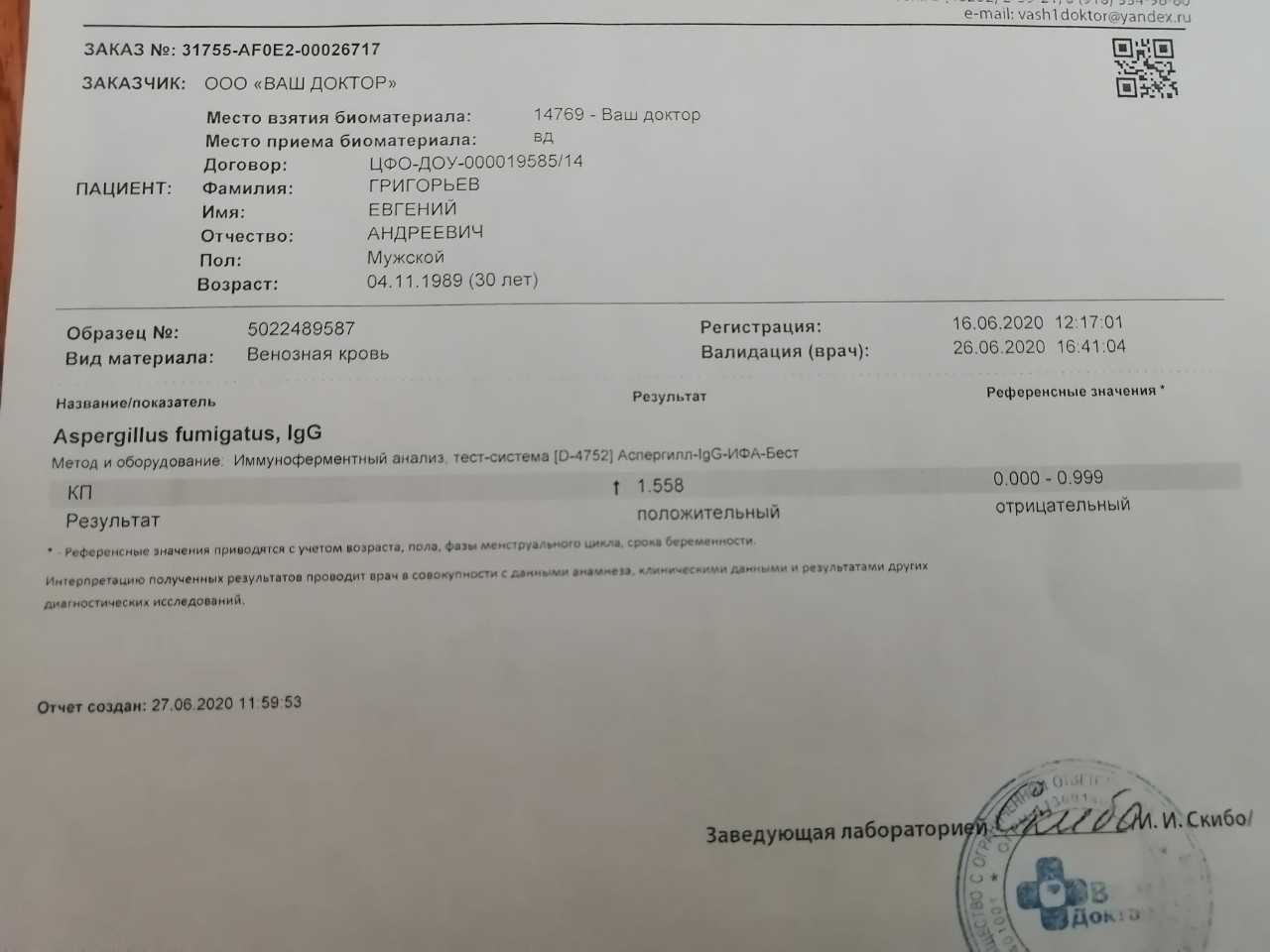Откосы котлована